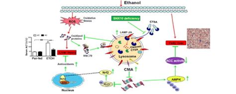 SNX10 Mediates Alcohol Induced Liver Injury And Steatosis Via