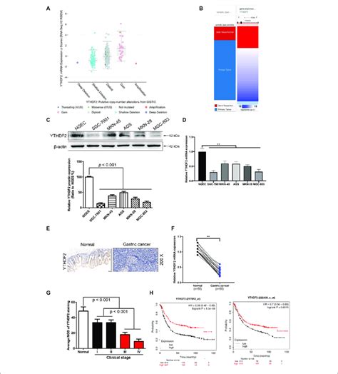 The Low Expression Level Of YTHDF2 In Gastric Cancer Is Closely