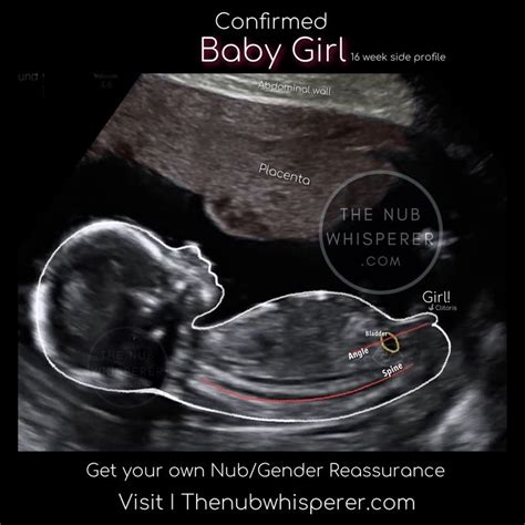 Baby Girl Gender Prediction Gender Prediction Nub Theory Baby