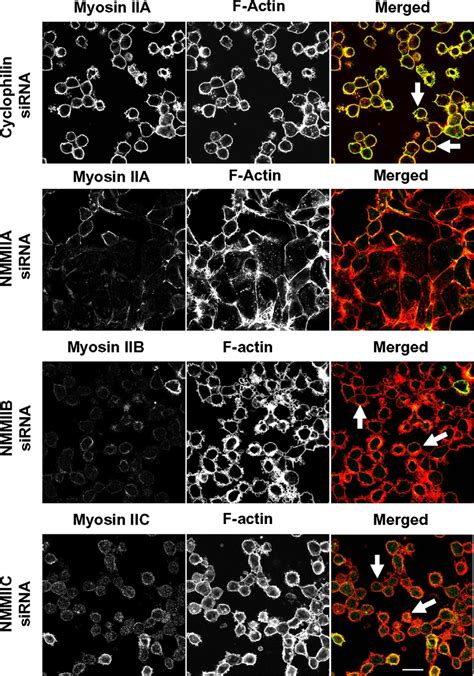 Sirna Mediated Knock Down Of Nmmiia Inhibits Cell Contractility