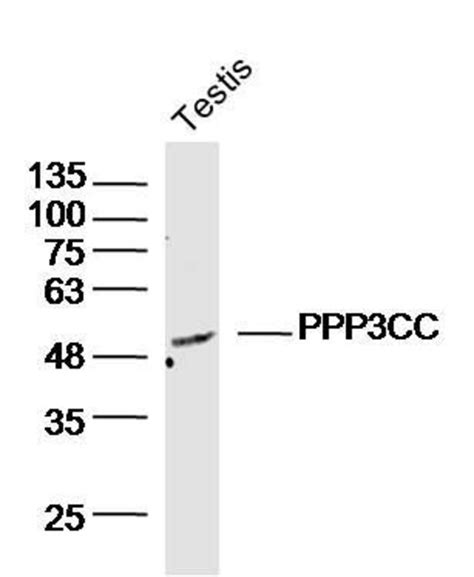 PPP3CC Rabbit anti Human Polyclonal Bioss 100 μL Unconjugated