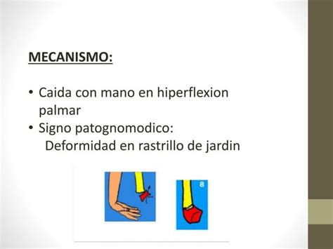 Fracturas De Radio Distal Ppt