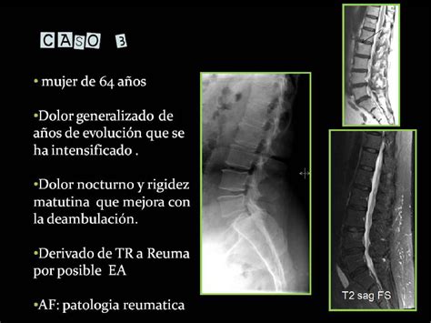 Figure 20 from Revisión de los hallazgos radiológicos en la