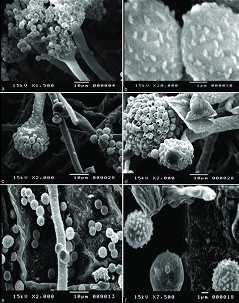 Scanning Electron Microscopy For A And B Untreated Aspergillus