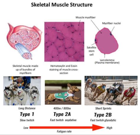 Skeletal Muscle Pathology Session 1 Flashcards Quizlet