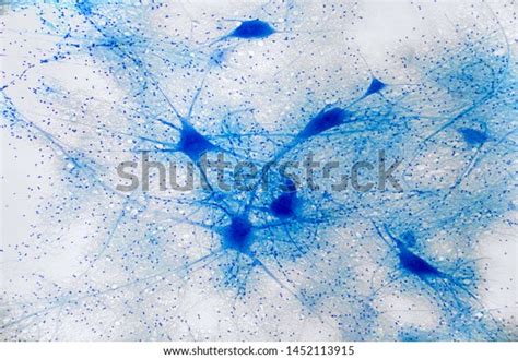 Photo Neurons Under Microscope View Stock Photo 1452113915 | Shutterstock