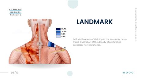 Trap Tox Botox Injection Technique Into The Trapezius Muscles