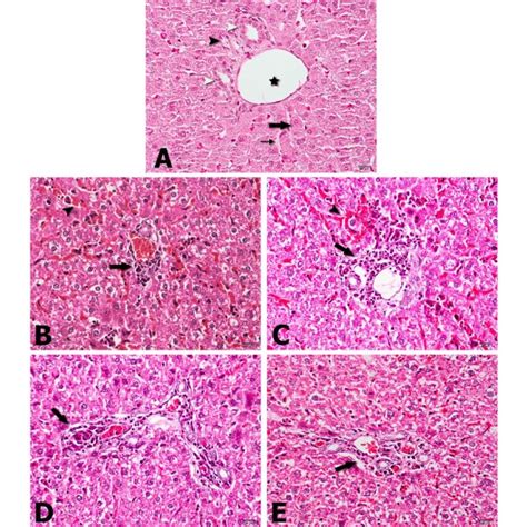 Photomicrographs Of Spleen A Normal Architecture Of Spleen From A