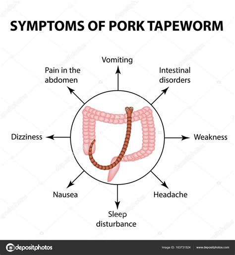 Symptoms of Pork tapeworm. Infographics. Vector illustration on isolated background Stock Vector ...