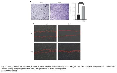 Cobalt Chloride Promotes Osteogenesis Of Rat Bone Marrow Mesenchymal