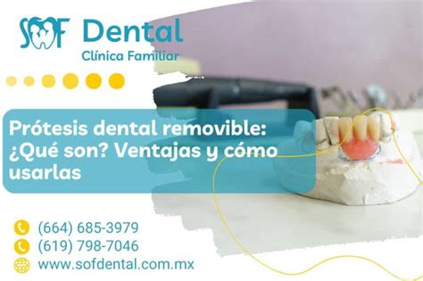 Pr Tesis Dental Removible Qu Son Ventajas Y C Mo Usarlas