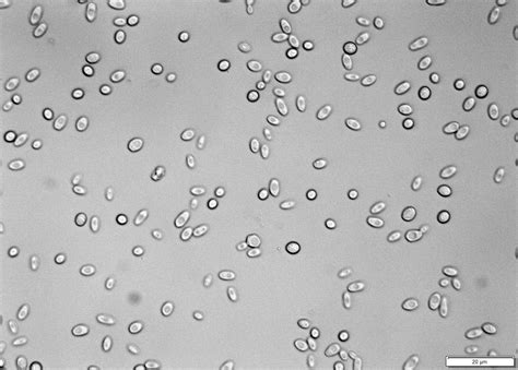 Saccharomyces Cerevisiae 4393 National Collection Of Yeast Cultures