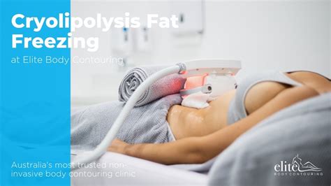 Cryolipolysis Fat Freezing Youtube