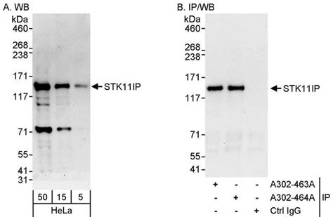 Stk11ip Polyclonal Antibody A302 464a