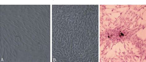 Figure 1 From Differential Effects Of 17beta Estradiol And Raloxifene