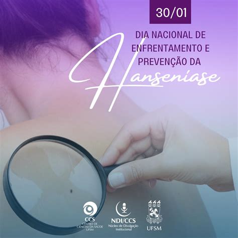 Dia Nacional De Combate E Prevenção Da Hanseníase Ccs