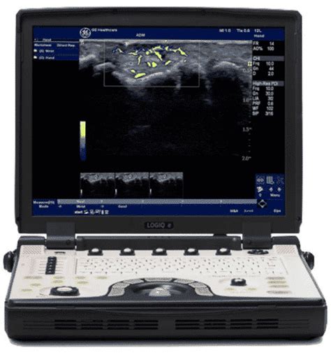 Ultrasound Machines And Probes For Imaging Abdominal Aortic Aneurysms