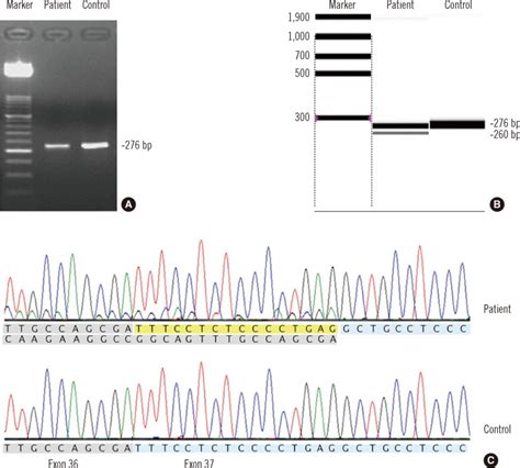 Results Of Agarose Gel Electrophoresis Of Rt Pcr Products A