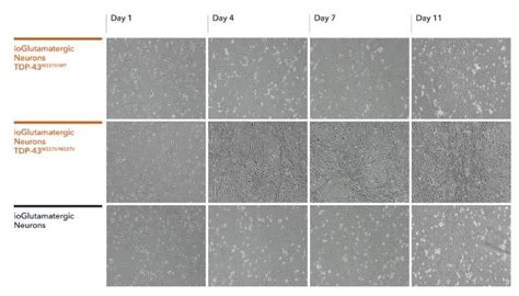 ioGlutamatergic Neurons TDP 43 M337V heterozygous 人iPSC derived cells