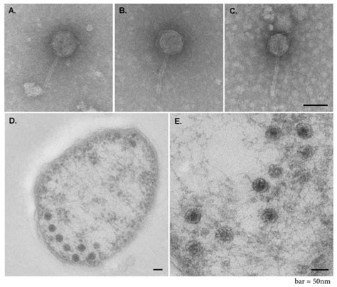 Electron Micrographs Of Francisella Phage Vb Fhim Kirk Ac