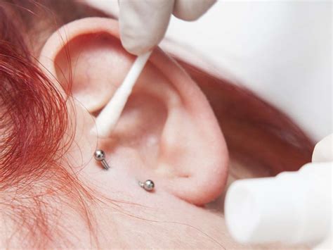 Piercing Near Me Infected Bump On Ear Lobe Piercing