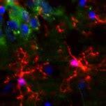 Microglia markers | Abcam