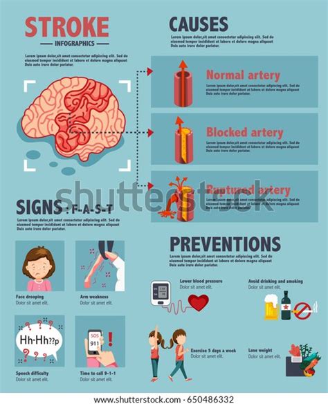 Hemorrhagic Stroke Symptoms Photos and Images | Shutterstock