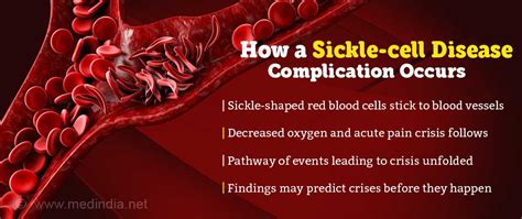 How Does Acute Pain Crisis in Sickle Cell Disease Arise?