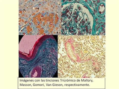 Principales tinciones en el laboratorio de anatomía patológica PPT