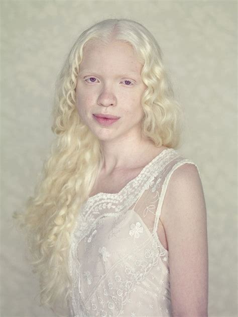 Beautiful Portraits Of Albinos By Gustavo Lacerda Albinism Beauty Beautiful People