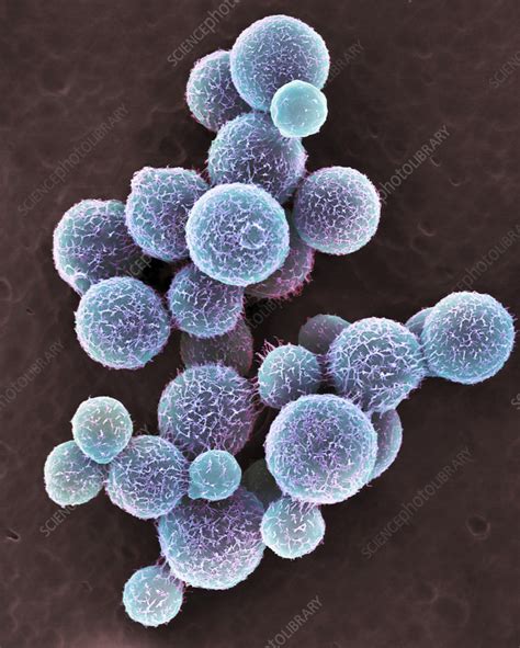 Cryptococcus Neoformans Yeast Sem Stock Image C0563901 Science Photo Library