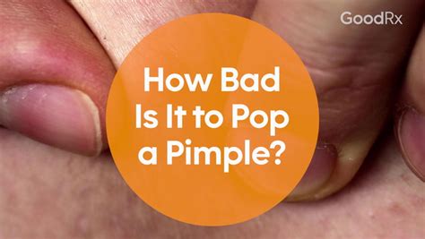 How Bad Is It to Pop a Pimple, Really? - GoodRx