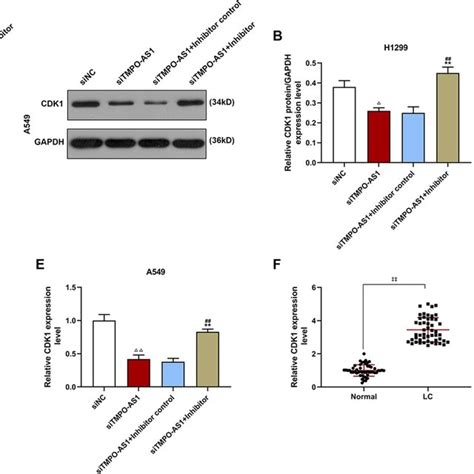 Tmpo As1 Affected Gene Expressions Of Cdk1 But The Effects Were