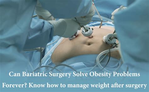 Can Bariatric Surgery Solve Obesity Problems Forever? Know How to