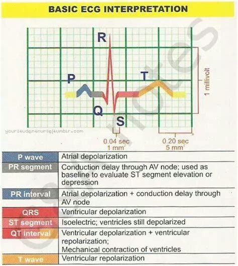 38 best Learning ECG Interpretation images on Pinterest | Nursing ...