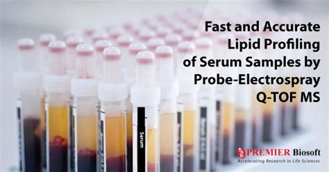 Fast And Accurate Serum Lipid Data Analysis Using Simlipid Lipid