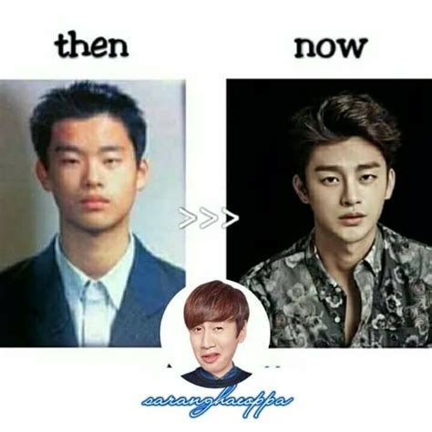 Seo In Guk Before And After