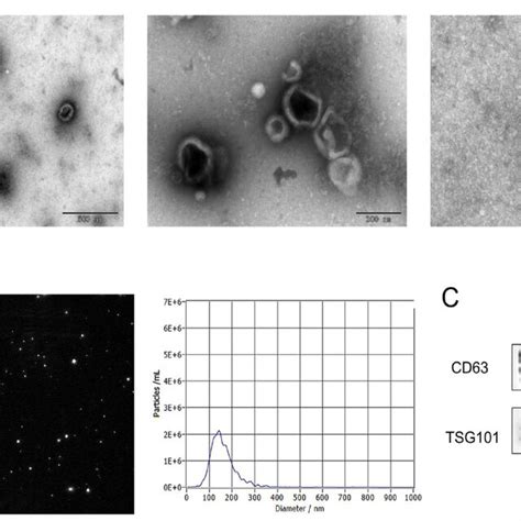 Identification And Characterization Of Tc Derived Exo A Transmission