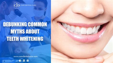 Debunking Common Myths About Teeth Whitening Cass Dental Care