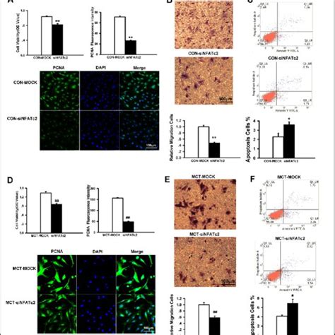 Silencing NFATc4 By SiRNA Reduced Proliferation Migration And