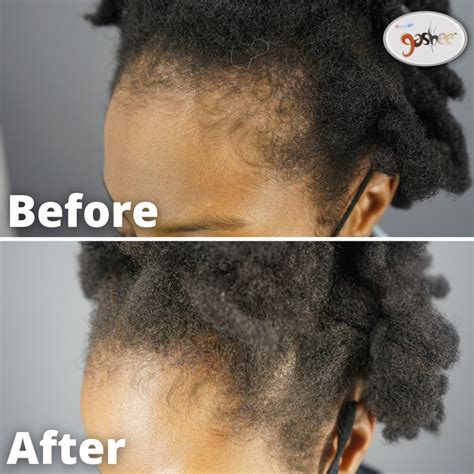 GASHEE Hair Stories: Amazing 4-Month Natural Hair Growth Results - Dr ...