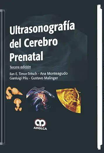 Ultrasonografía del Cerebro Prenatal 3 Edición