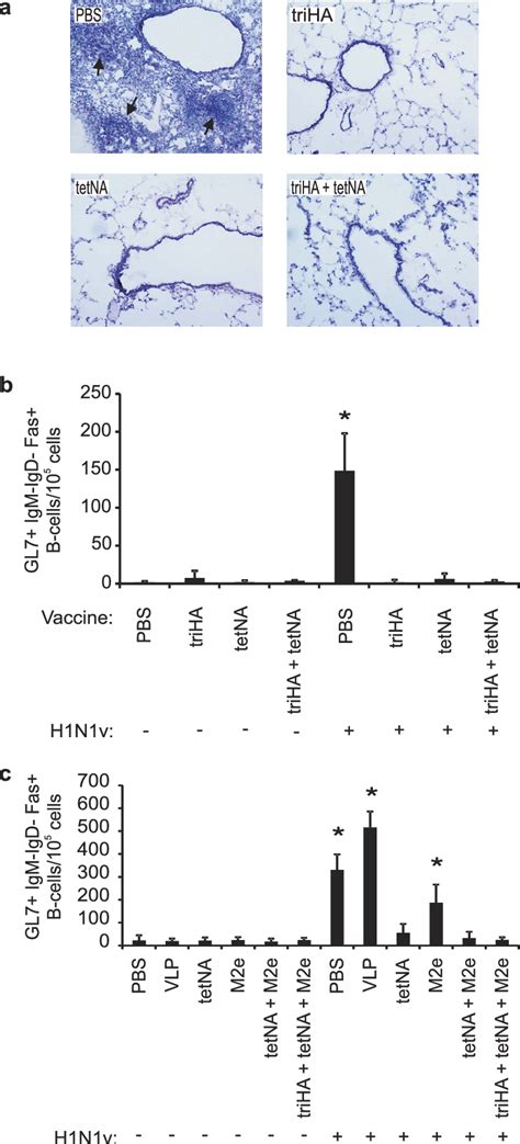 Formation Of Inducible Bronchus Associated Lymphoid Tissue IBALT