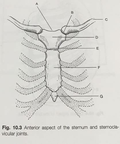 POSITIONING Workbook Chapter 10 Bony Thorax Labeling 10 3 Flashcards