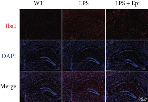 Epi Intervention Suppressed Lps Induced Hippocampal Microglial