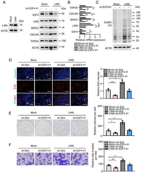 Transcription Factor E2f4 Facilitates Sumoylation To Promote Hcc