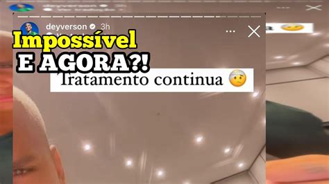 Fato Deyverson trata ombro no Cuiabá e será reavaliado na véspera de