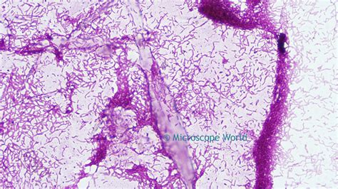 Microscope World Blog: Rhodospirillum Rubrum (Bacteria) under Microscope