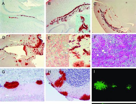 Light Microscopy Analysis Of Brain From Scrapie Infected GPI PrP Tg And