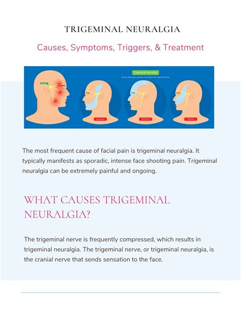 Ppt Trigeminal Neuralgia Causes Symptoms Triggers And Treatment Powerpoint Presentation Id